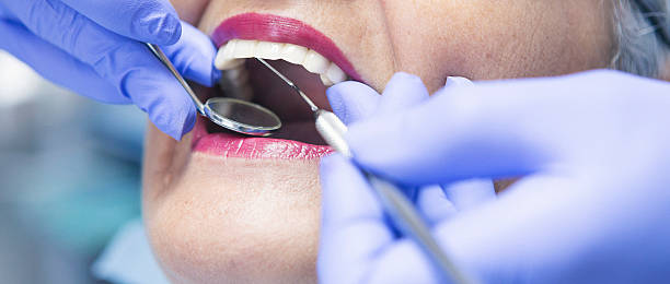Best Emergency Dental Care for Broken or Chipped Teeth in Butler, IN